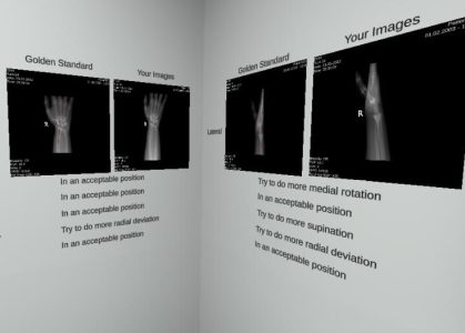 X-ray, diagnostic imaging